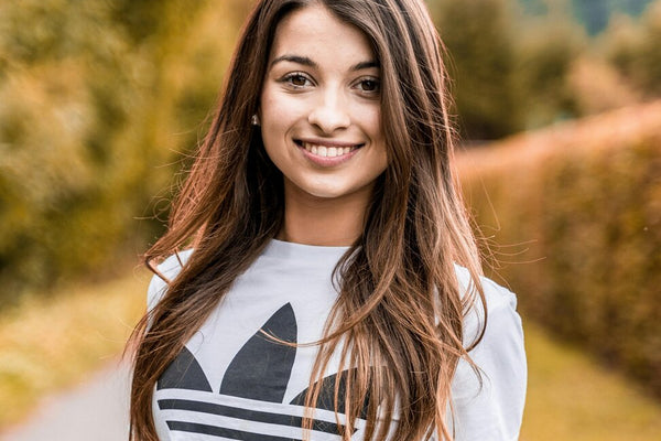 Adidas trademarks - what's the goal of the portfolio?